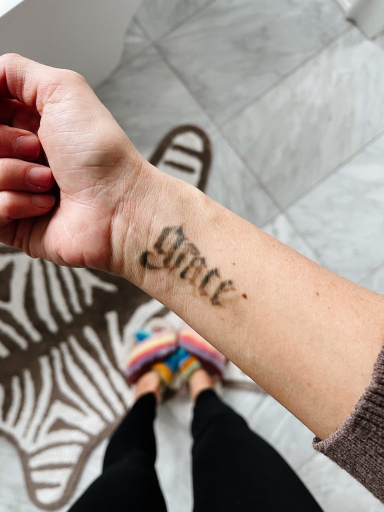 Tattoo removal update: "grace" tattoo on Suzanne's wrist