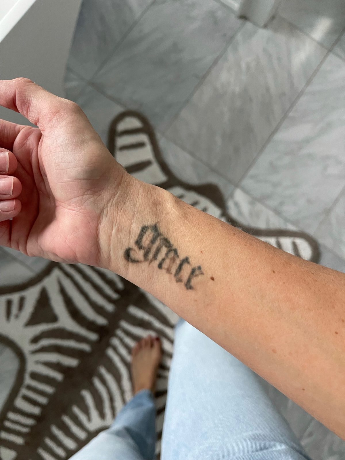 Tattoo removal update: "grace" tattoo on Suzanne's wrist